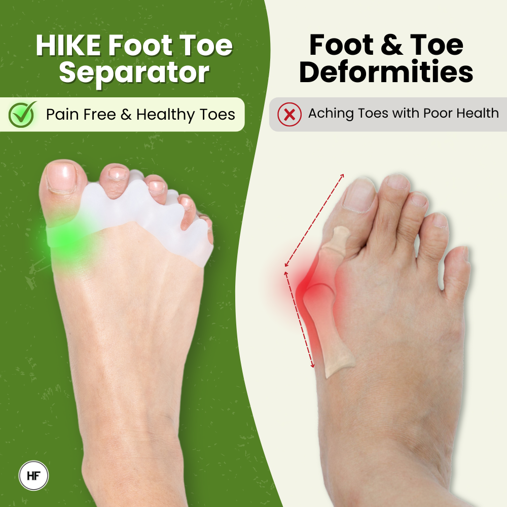 HIKE Foot Toe Separator - Achieve Healthy Toes, Correct Bunions, Hammer Toes, and Relieve Foot Pain